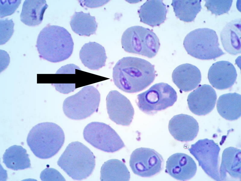 Мазок крови, окрашенный. Стрелочкой показано наличие пироплазмы в клетке крови.