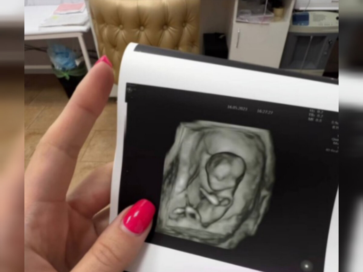 Скрининг ребёнка Лизы Полыгаловой. Источник: соцсеть