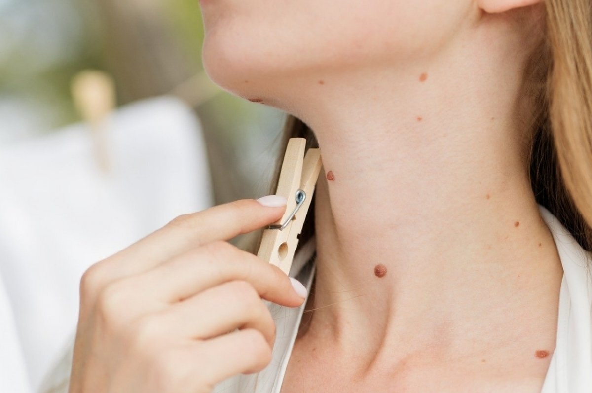    Северяне смогут бесплатно посетить врача-дерматолога