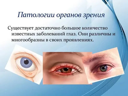 взято из общего доступа