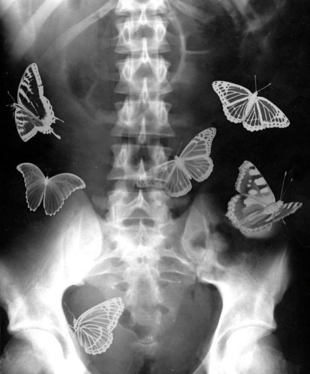 Бабочки в животе арты