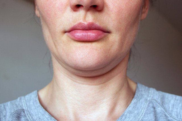    Почему при похудении первыми опадают щеки и грудь, а жир в бедрах остается?