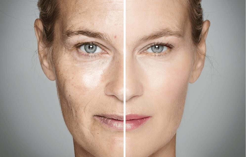 Сравнение, как влияет на кожу лица процесс фотостарения.