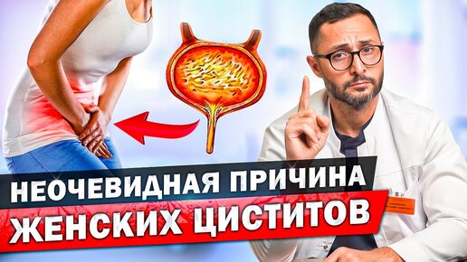 Цистит у женщин после секса? Что делать? Обязательно покажи это видео девушке