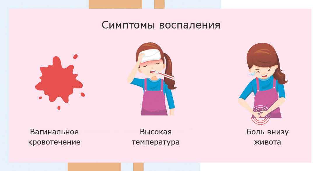 Симптомы воспаления матки