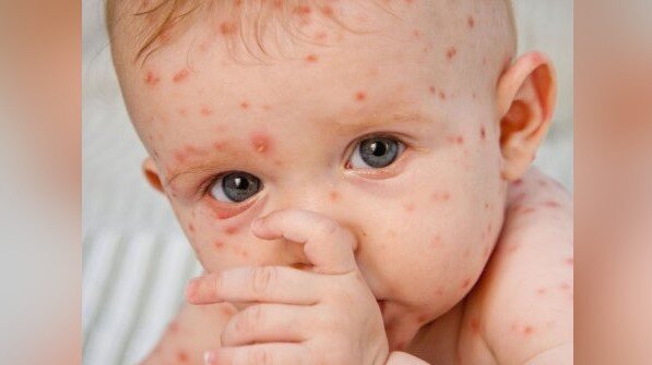 Дети в группе риска. Фото: fcgie.ru