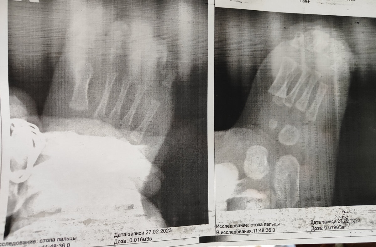 Тут на снимке ещё моя рука, я придерживаю ножку 