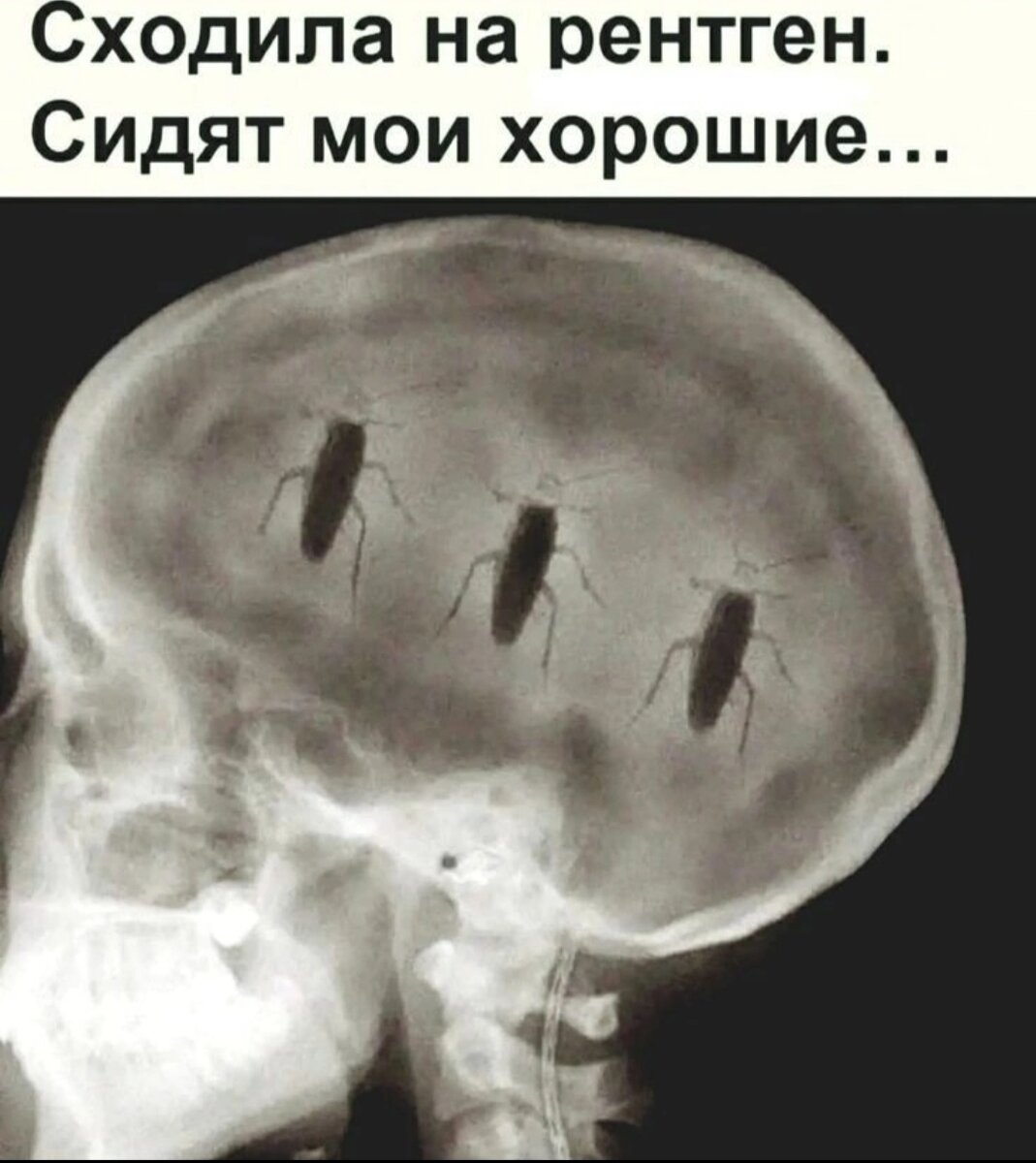 Рентген юмор