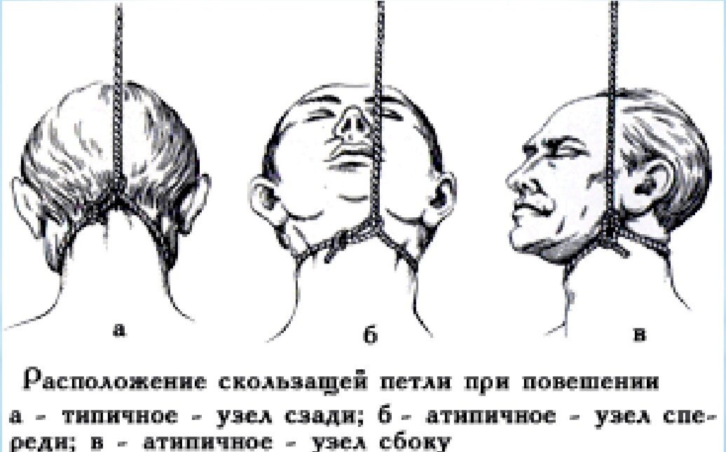 Как узел для повешения