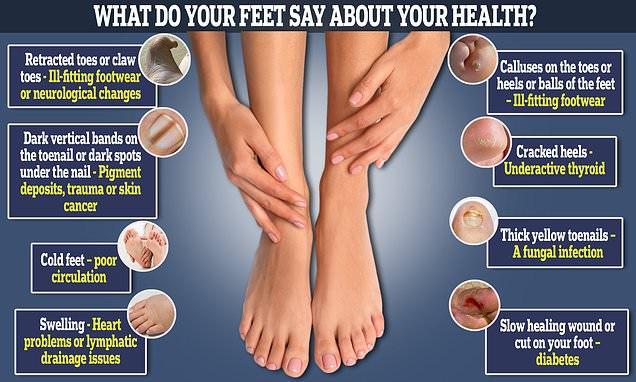 Потемнение кожных покровов на ногах или пигментация кожи