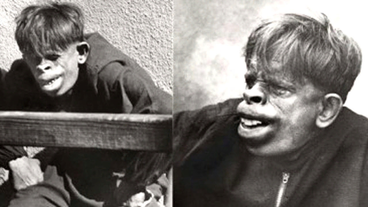 Человек-обезьяна найденный в джунглях бразилии 1937 год. Оливер обезьяна человекообразная. Скрещивание человека и обезьяны. Оливер человек шимпанзе. Оливер человек шимпанзе.