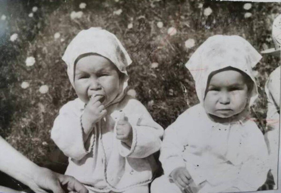     То, что ноги не похожи на ноги других людей, девочки понимали, когда еще были маленькими. Фото: предоставлено героями публикации