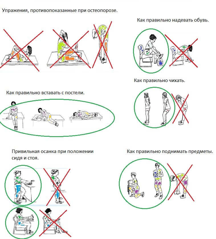 Гимнастика при остеопорозе