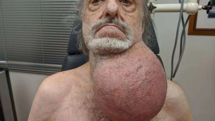 https://hi-news.ru/wp-content/uploads/2019/11/pre_surgery-750x422.jpg