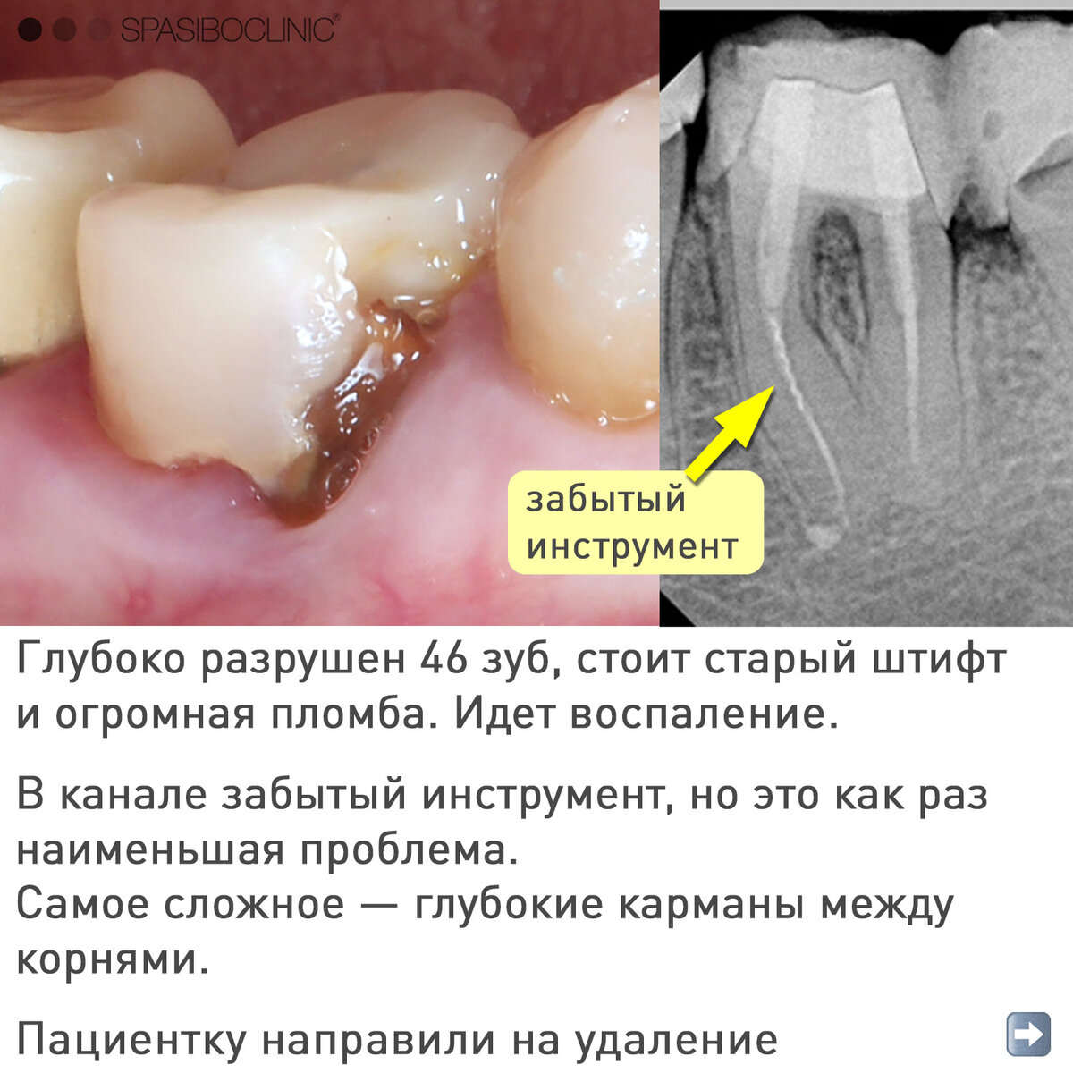 фанфик пересчитай свои зубы фото 49