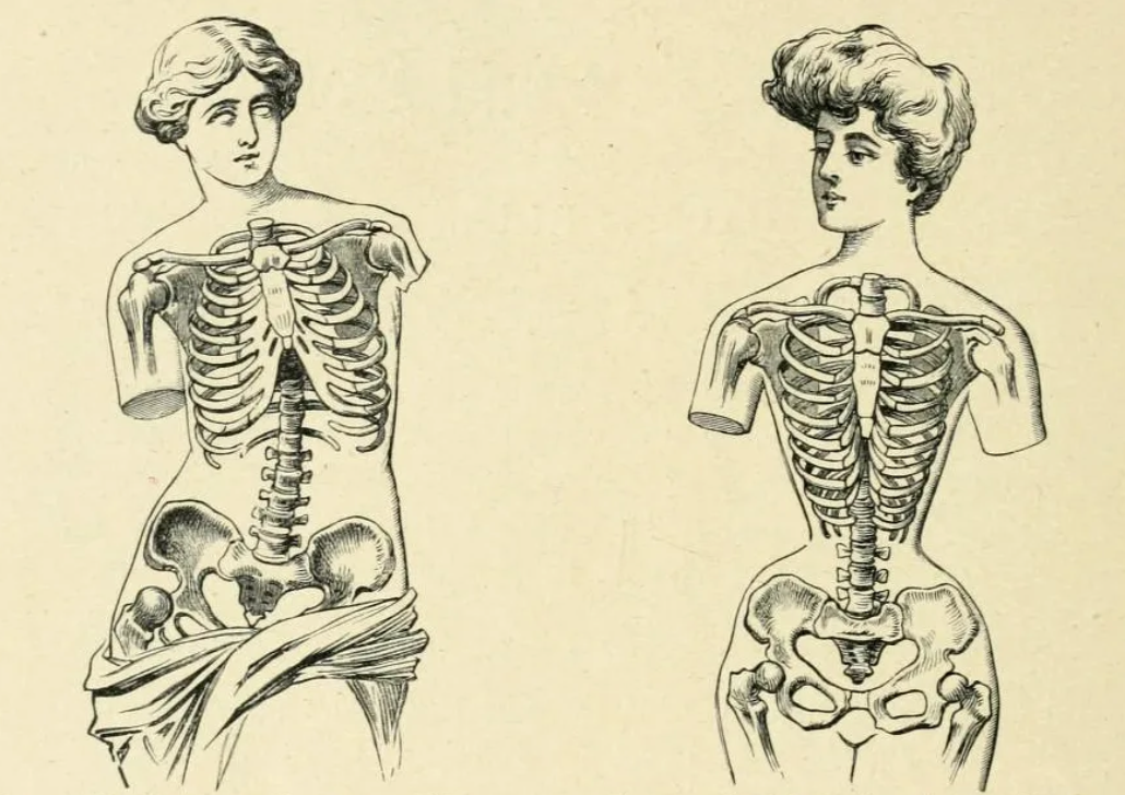 У мужчины на 1 ребро меньше. Ребра после корсета рентген. Корсет 19 века деформация ребер. Корсет 19 век. Корсеты 18 века деформация органов.