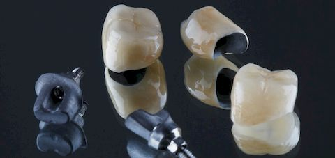 Металлокерамическая коронка