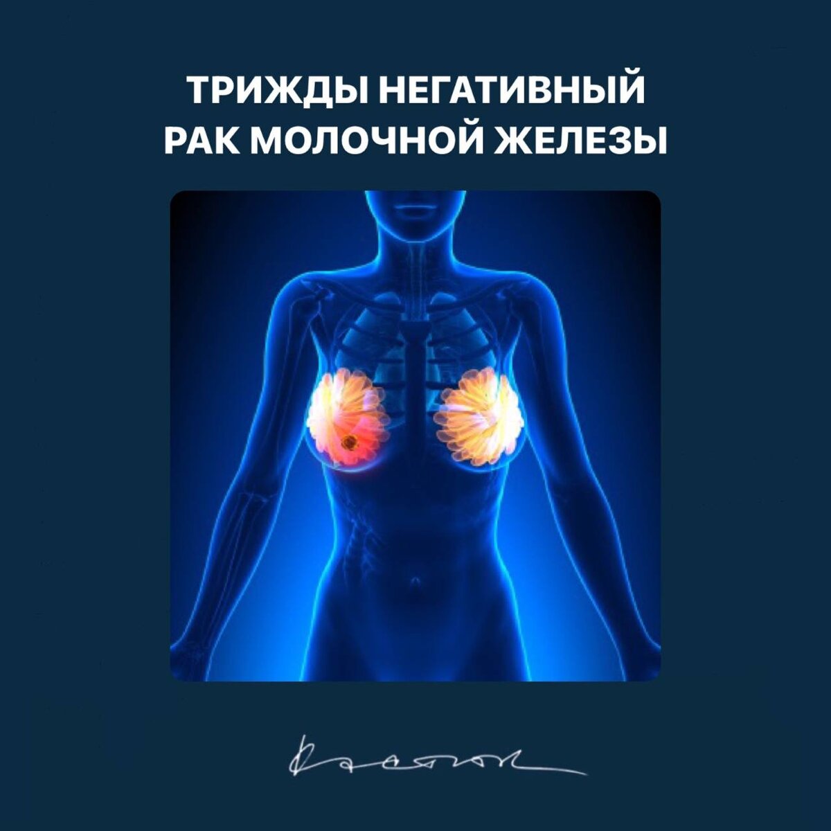 КАК ПРЕДУПРЕДИТЬ РАК МОЛОЧНОЙ ЖЕЛЕЗЫ? Территориальный Фонд ОМС Пензенской област