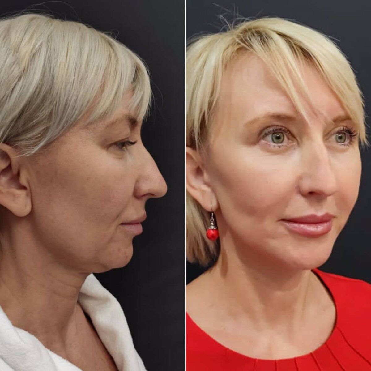 Ageless total facial cleanser. Image skincare ageless eye. F. Total face. Image skincare iluma exfoliating cleanser 113gr.