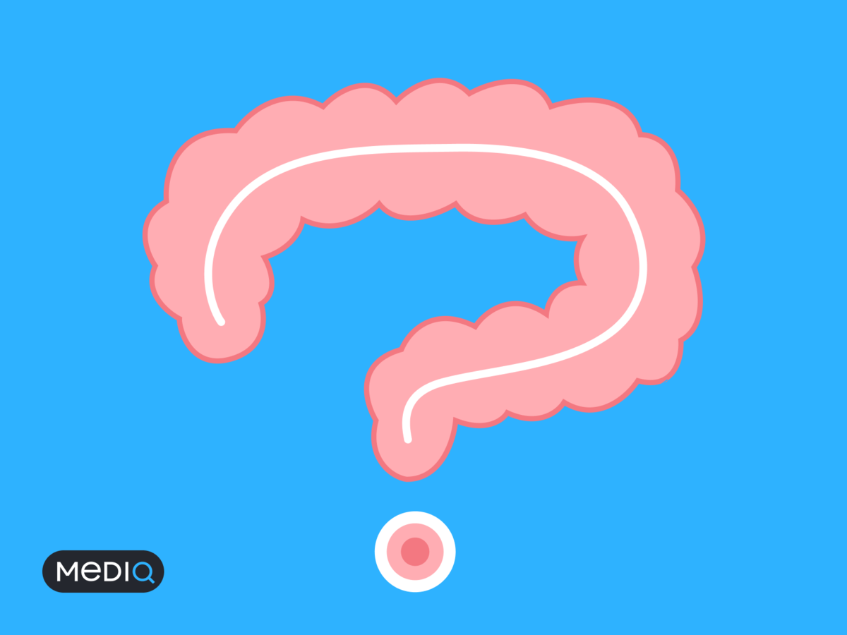 Колоноскопия спасает от смерти! Или не всех? | Пей Таблетки! | Дзен