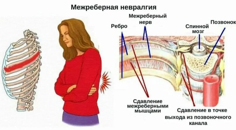 Кардионевроз или к чему может привести затяжной стресс