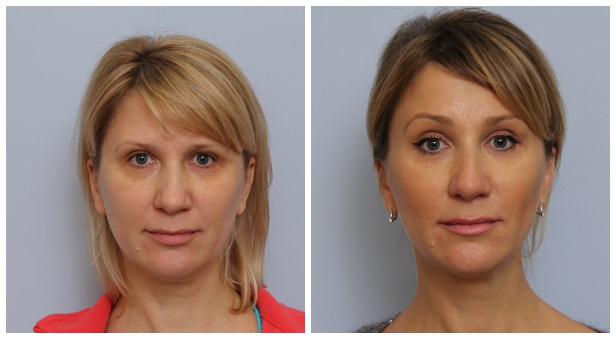 Результаты до и после 