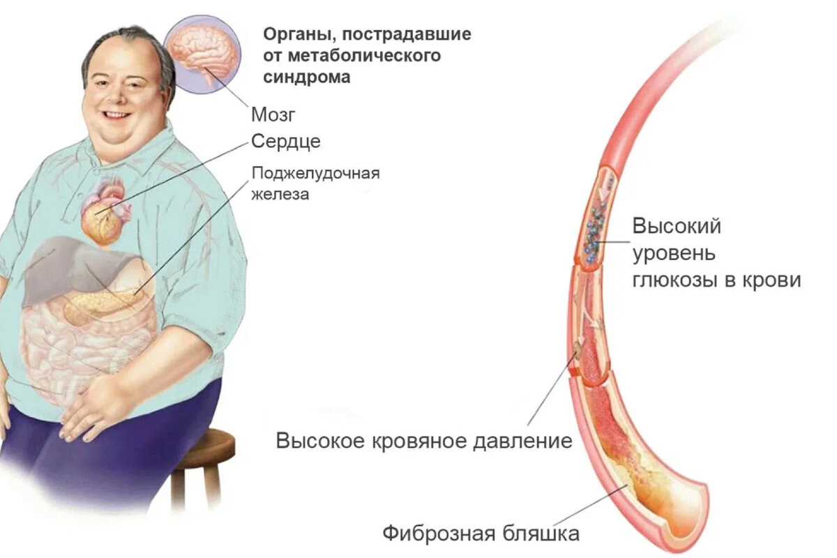 Состояние требует особого внимания. Пускать на самотёк ни в коем случае нельзя 