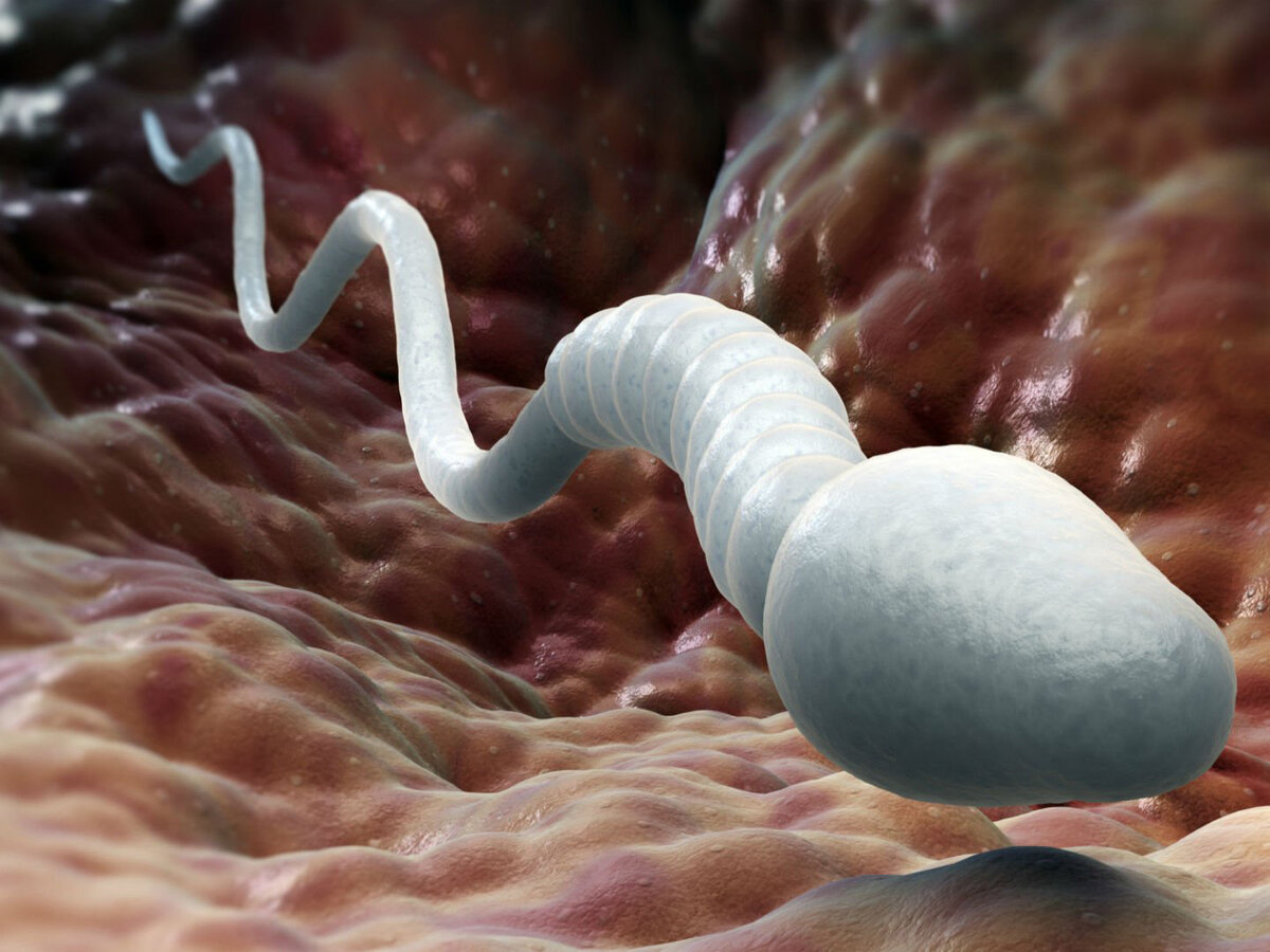Нарушения сперматогенеза
