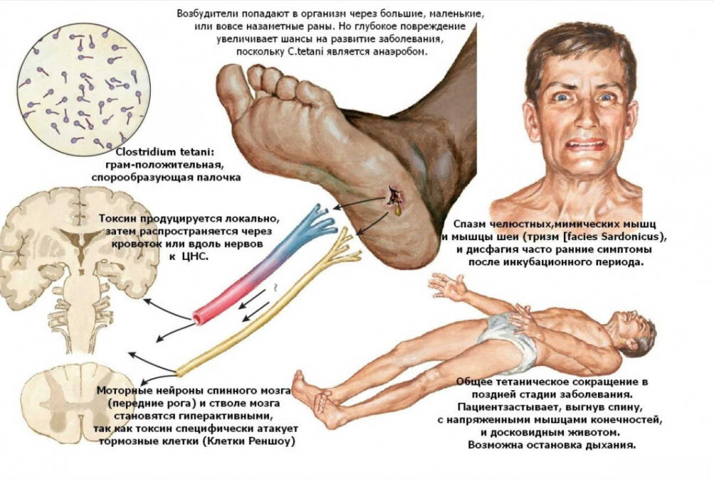 Картинка клиническая картина