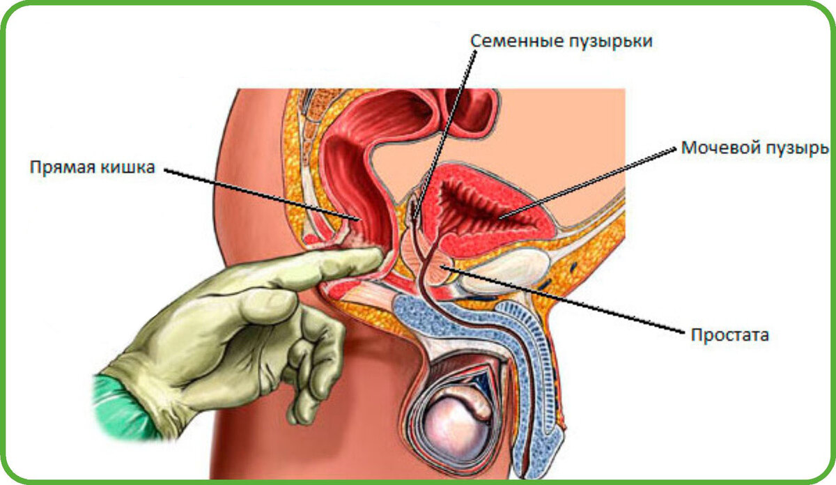 оргазм массаж простаты техника фото 103