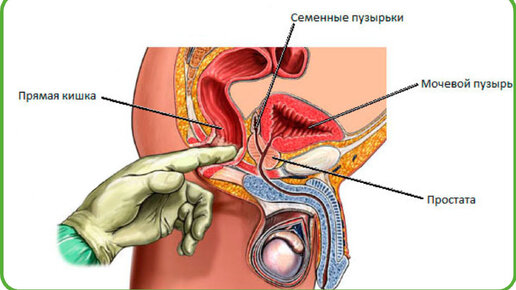 Совсем неплохо с другой стороны: оргазм и польза от массажа простаты 🍑
