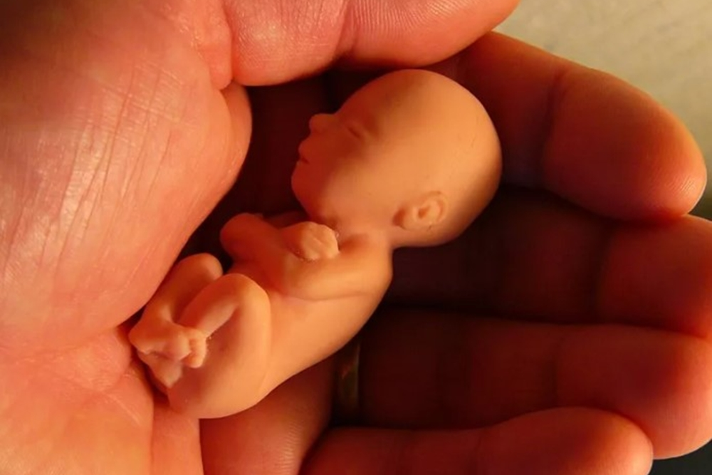 Замершая беременность