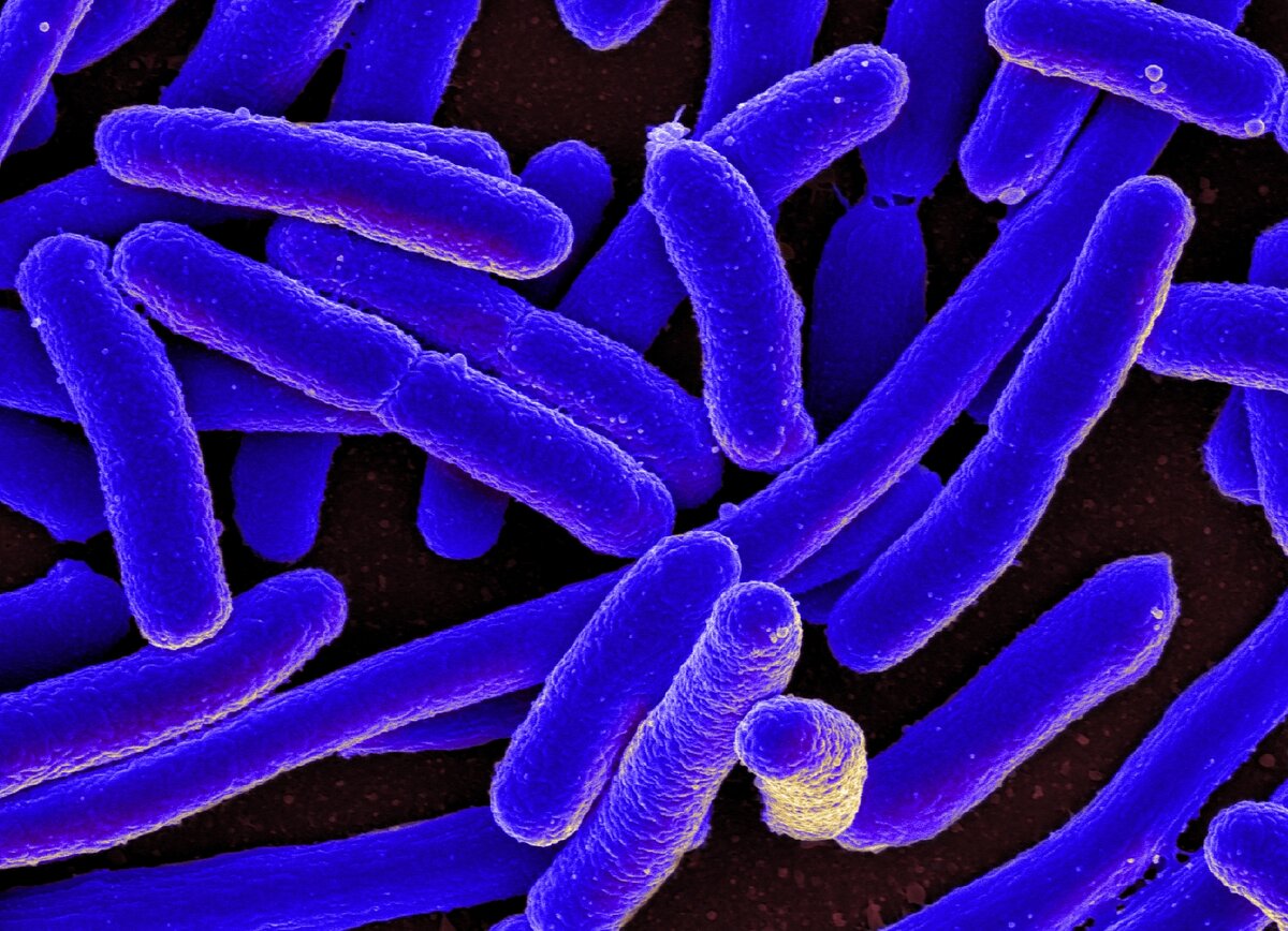 Бактерия Escherichia coli. Кишечная палочка Escherichia coli. Кишечная палочка микрофотография. Бактерия кишечная палочка.