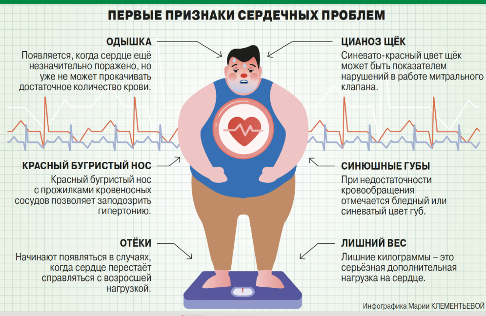    Инфографика:  АиФ