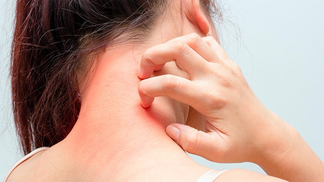 10 заболеваний кожи