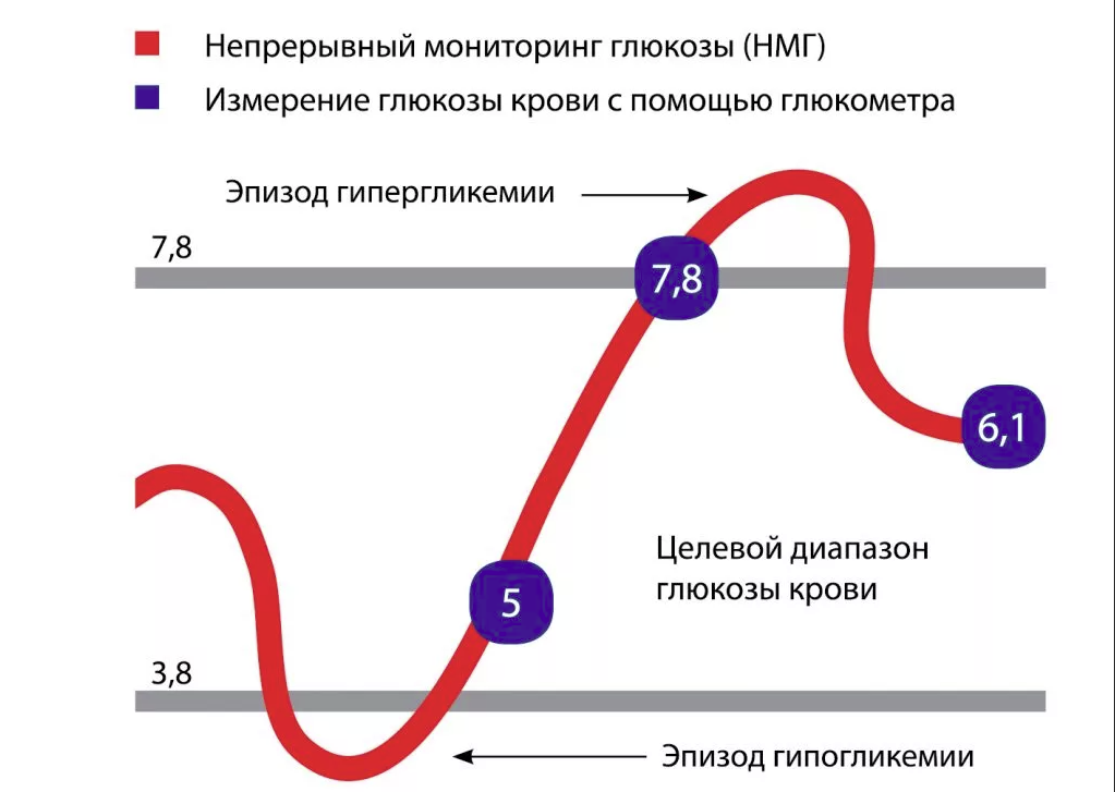 Системы мониторинга уровня глюкозы. Сенсор непрерывного мониторинга уровня глюкозы. система непрерывного мониторинга уровня глюкозы (нмг). непрерывный мониторинг глюкозы классификация.