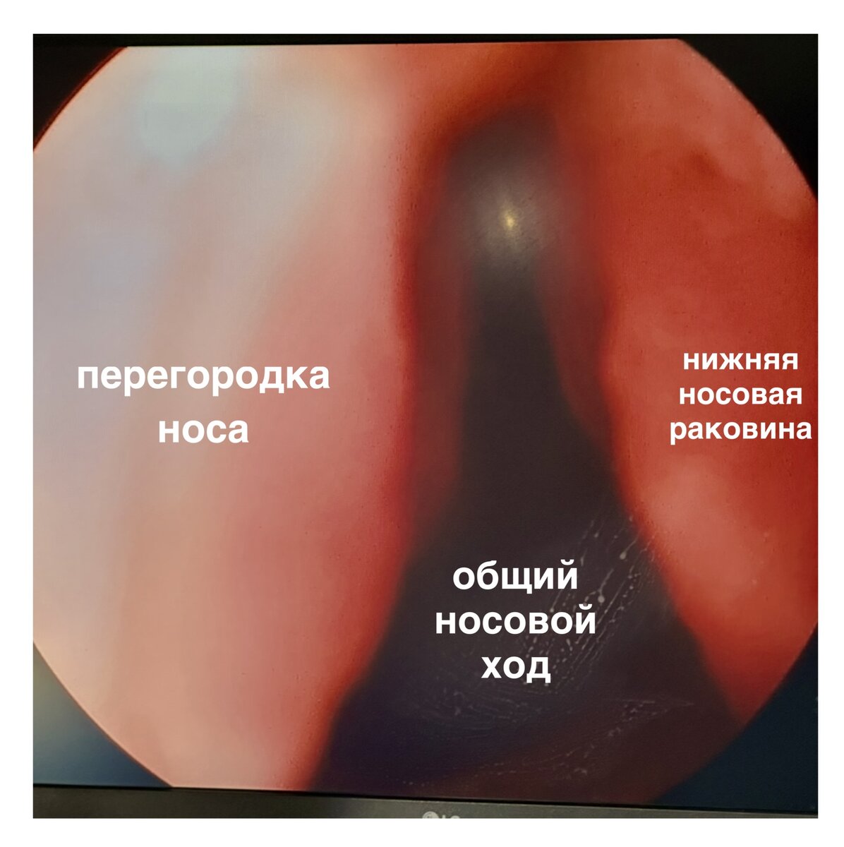 -1-2