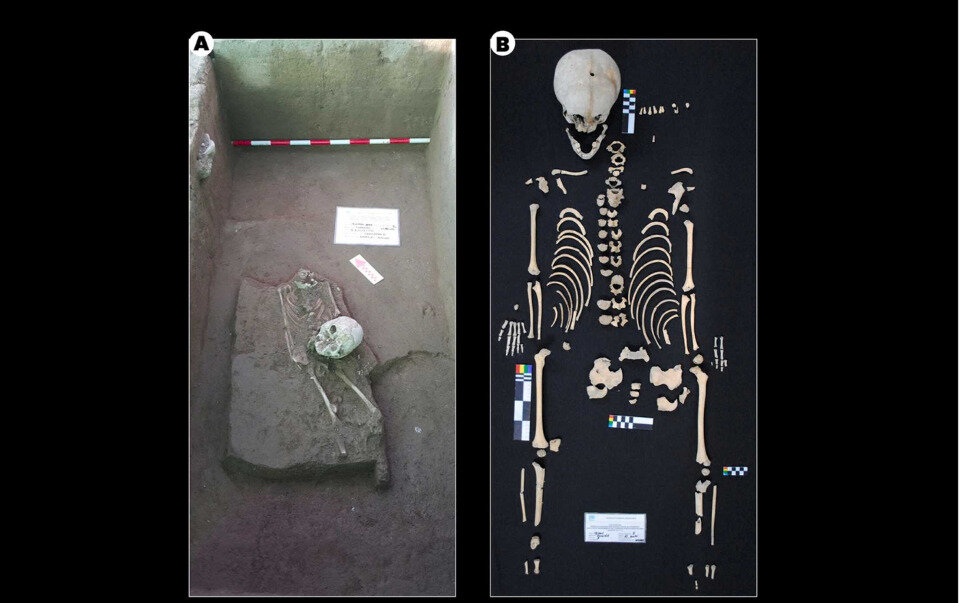   Claudia Rojas-Sepuleveda et al. / International Journal of Paleopathology, 2023