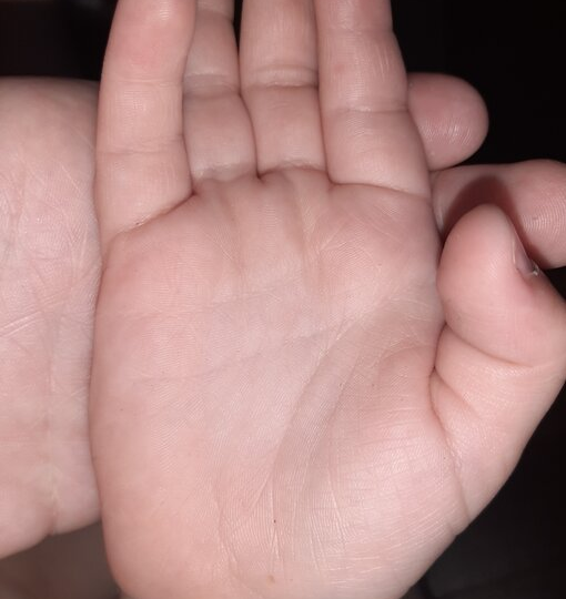 "Удастся ли ребёнку справится с болезнью?" Подсказывают руки. Из рубрики "Вопрос - ответ".