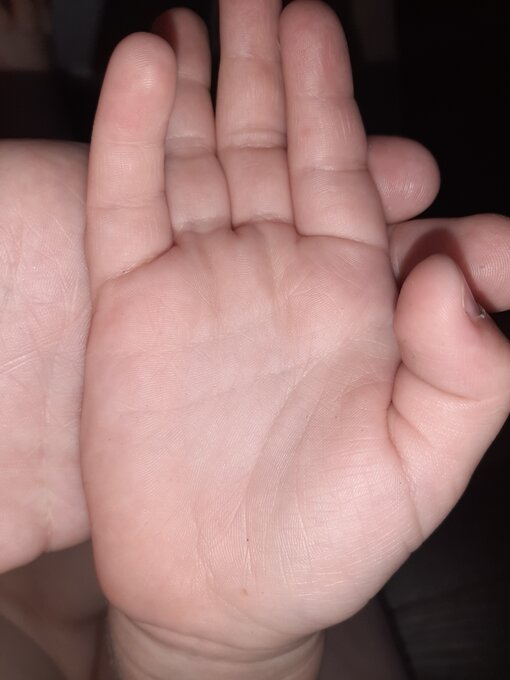 Правая рука ребенка. Из личного архива. 