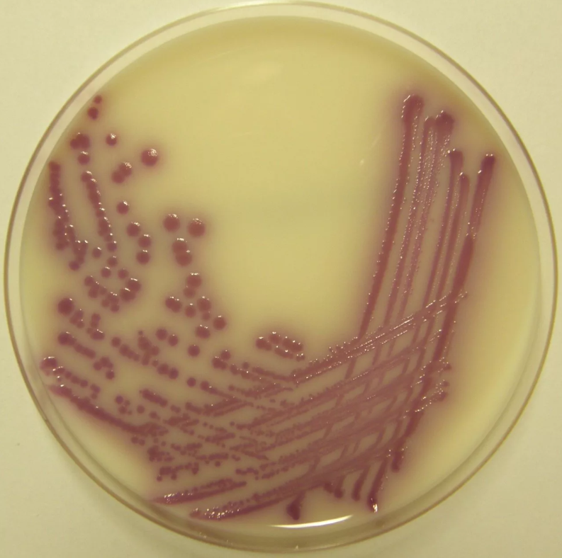 Сальмонелла в воде. Сальмонеллы на мпа. Сальмонелла энтеритидис микробиология. Сальмонелла на чашке петри. Сальмонелла в воде.