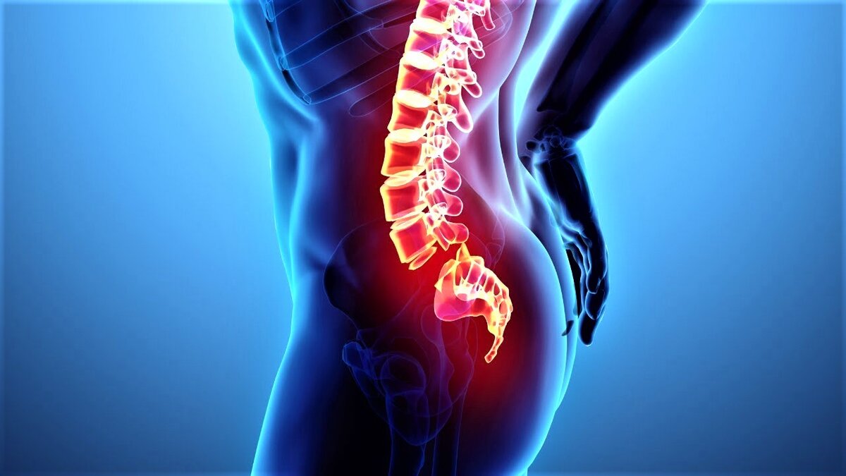 Боль в копчике. Причины, симптомы, лечение