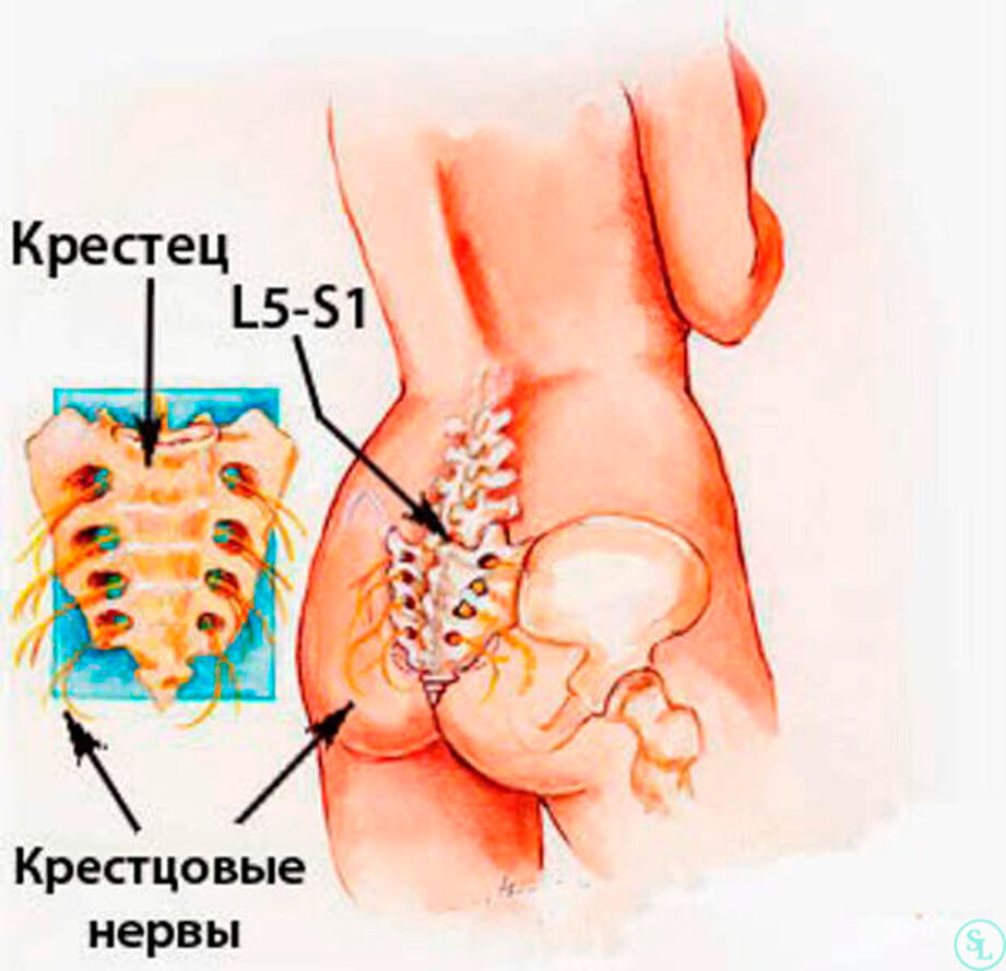 Где крестец у человека фото. Крестец и копчик анатомия. Крестцово-копчиковый отдел позвоночника. Копчико крестцовый отдел позвоночника. Пояснично-крестцовый и крестцово-копчиковый отделы позвоночника.