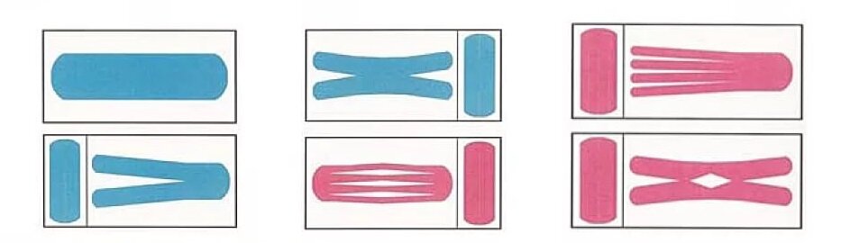 картинка с сайта https://kinesio.ru/taping/scheme-kinezioterapiya/
