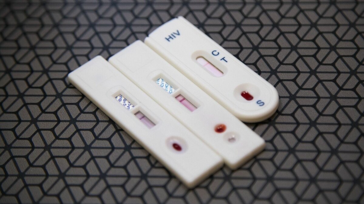     Однако диагноз ВИЧ будущая мать в силах не передать ребенку.