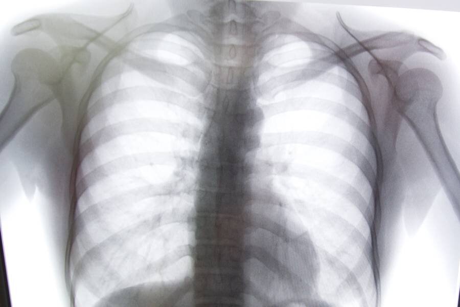 Рентгеновский снимок, фото: Андрей Гордеев / Ведомости/ТАСС