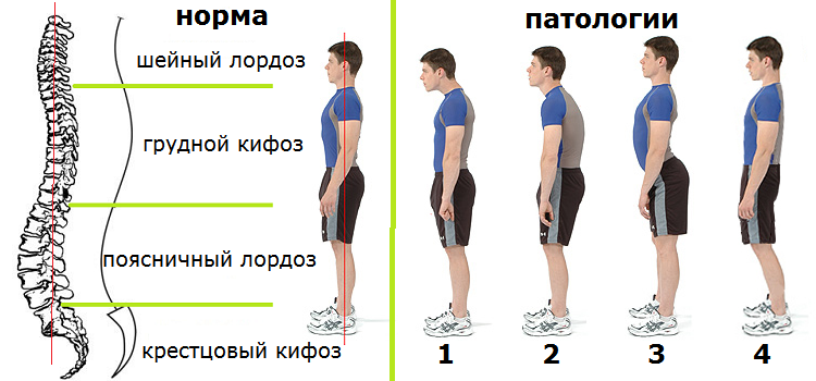 Как должен выглядеть позвоночник БОЛИТ ПОЯСНИЦА - ЧТО ДЕЛАТЬ? 4 ПРИЧИНЫ Дмитрий Трошин PRO "Движение" Дзен