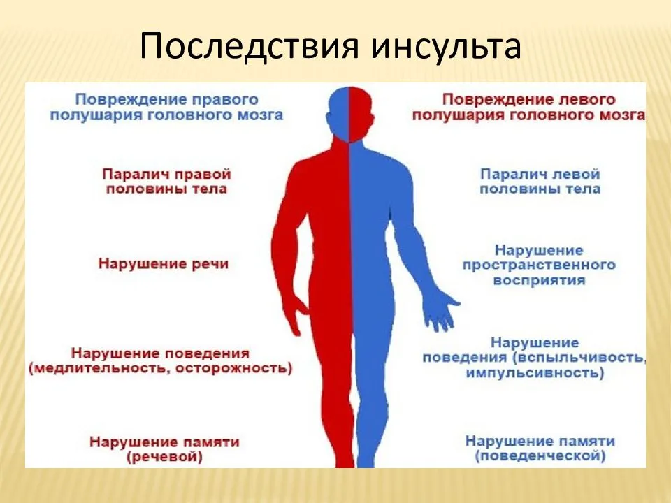 Чувствительность после инсульта