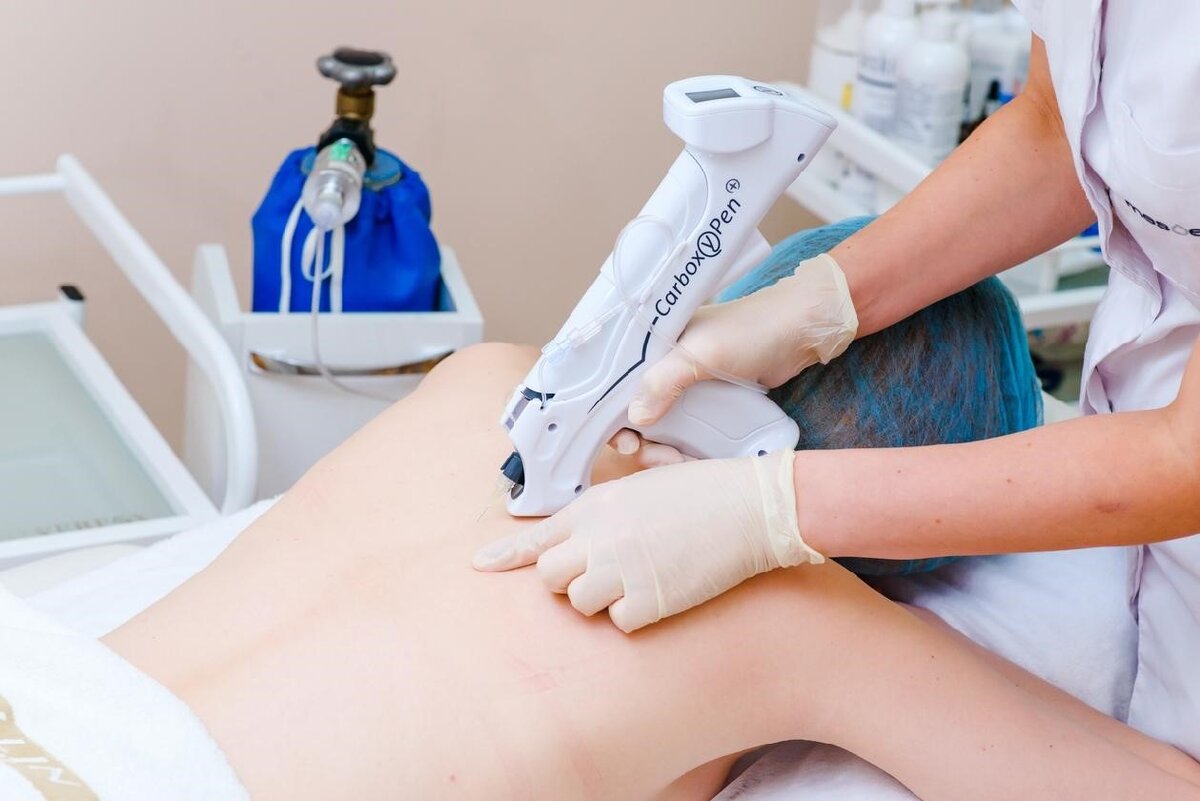 Карбокситерапия для лица безинъекционная. Карбокситерапия со2 газом. Карбокситерапия безинъекционная. Карбоксия. Неинвазивная карбокситерапия маска.
