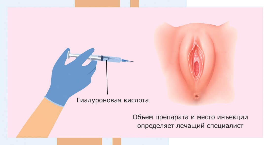 Половая система — что это, определение и ответ